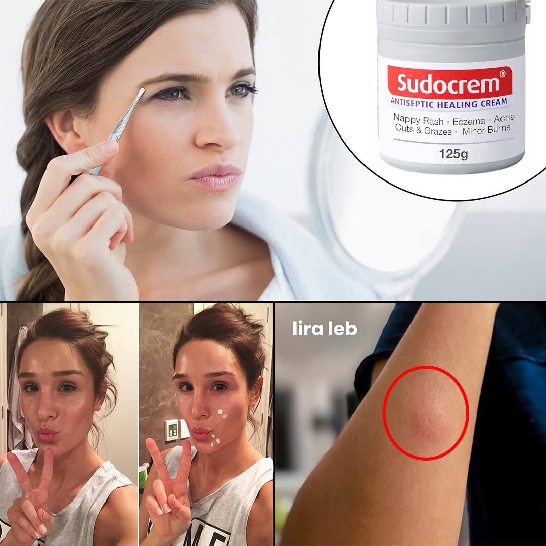 Sudocrem Antiseptic Healing Cream
