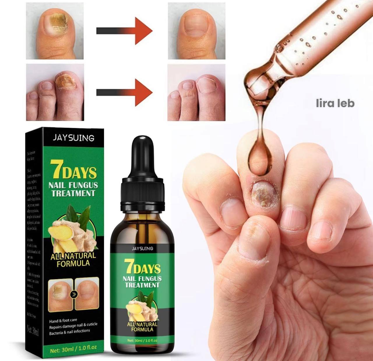 Ginger Nail Treatment Nail Serum 7Days
