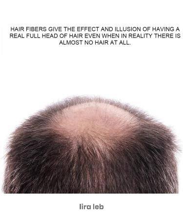 KINGYES 130g Hair Loss Filler Hair Spray