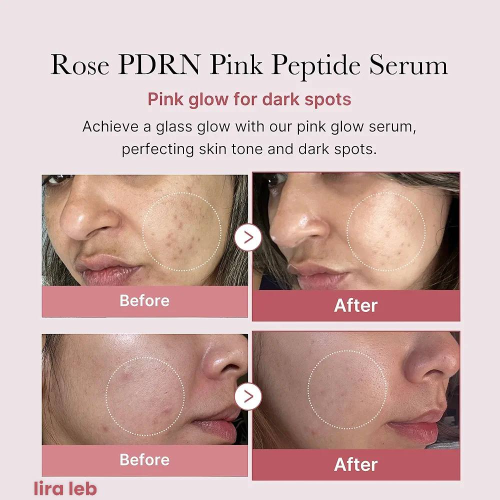 Medicube Pink Serum Niacinamide Hydrating And Moisturizing