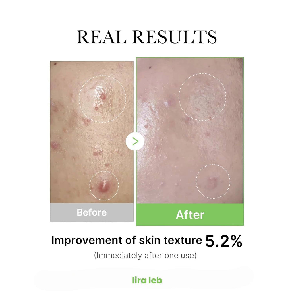 Medicube Exosome Cica Tea For Sensitive Skin