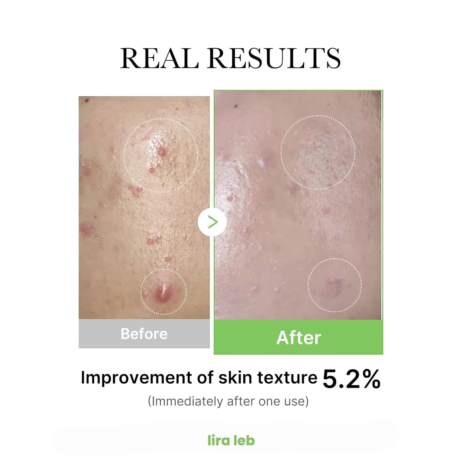 Medicube Exosome Cica Tea For Sensitive Skin