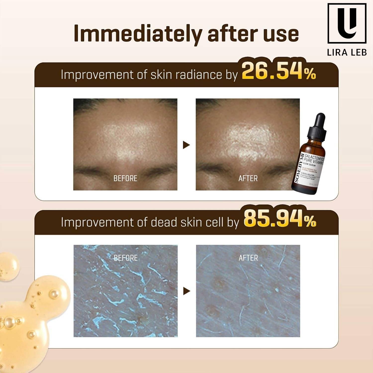 SOME BY MI Galactomyces Pure Vitamin C Glow Serum 30ml