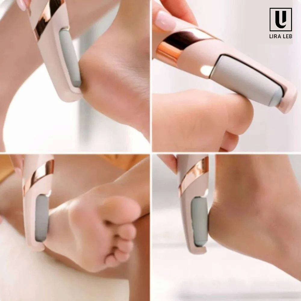 Electric Foot File, Electric Callus Remover
