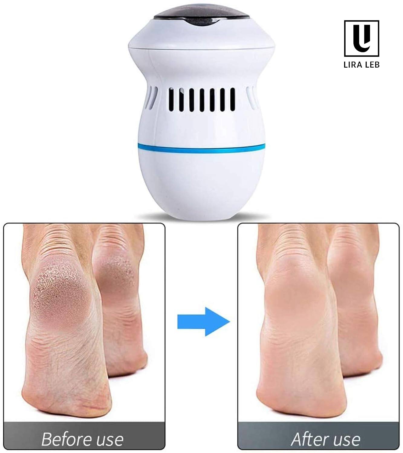 Electric Callus Remover Rechargeable Electric Foot File Removal