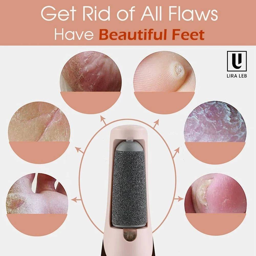 Electric Foot File, Electric Callus Remover