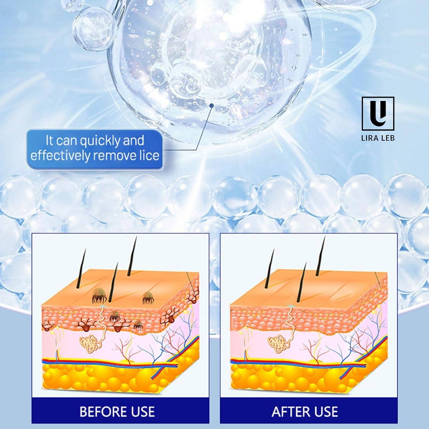 Disaar Hair Soap Against Lice